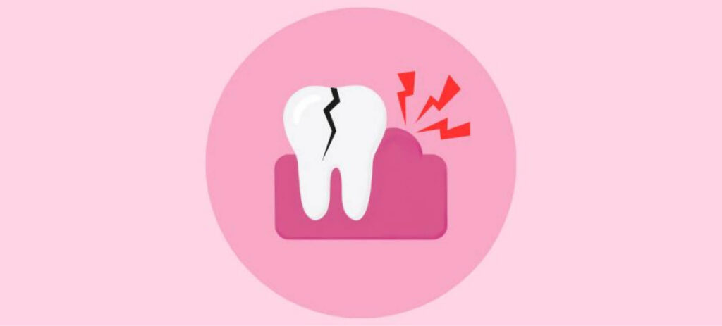 Graphic of a cracked tooth with red pain lines and infected gums, set on dark pink gums and a light pink background, representing a dental emergency.